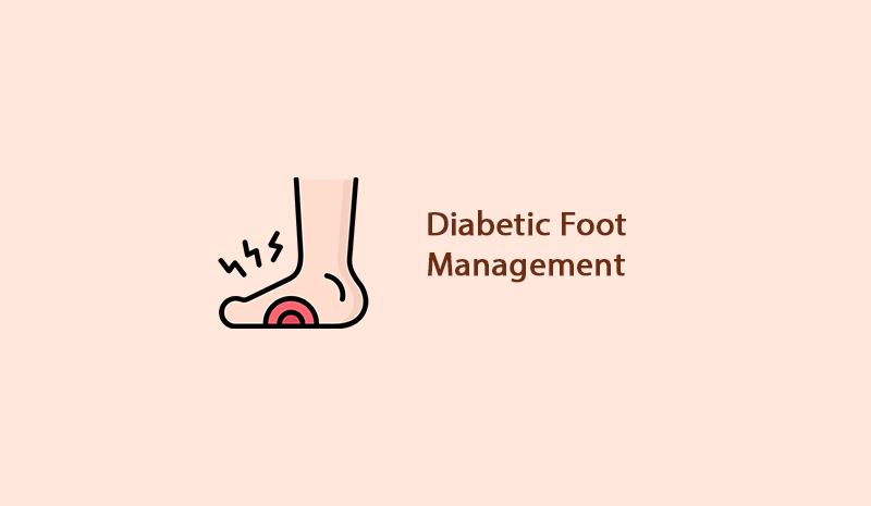 Management of Diabetic Foot in Ambur - KM NU Hospitals